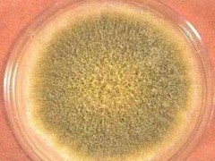 黃曲霉毒素B1檢測一下需要多少錢